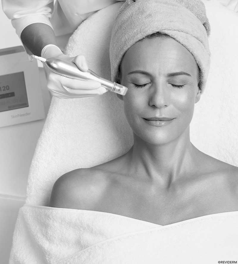 gesichtsbehandlungen mikrodermabrasion-2